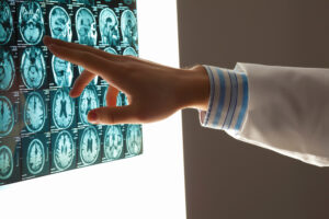 brain injury lawyer with a doctor pointing at MRI scans of a brain